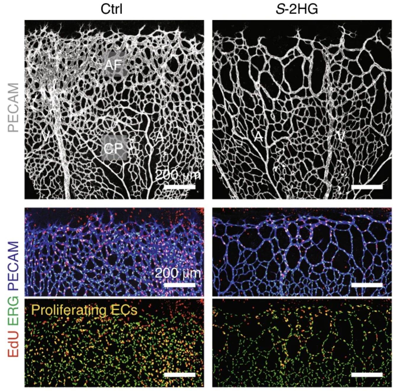 Metabolites Slam the Brakes on Blood Vessel&nbsp;Growth